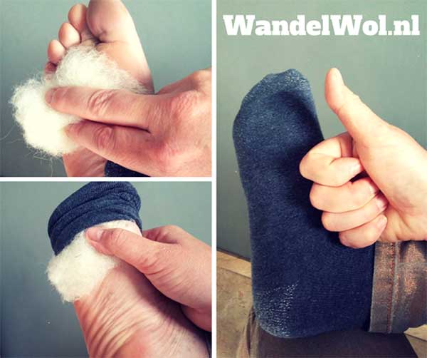 medisch pedicure jolanda wandelwol